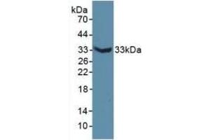 Detection of Recombinant MAP6, Mouse using Polyclonal Antibody to Microtubule Associated Protein 6 (MAP6) (MAP6 抗体  (AA 177-387))