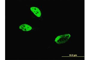 Immunofluorescence of monoclonal antibody to HLF on HeLa cell. (HLF 抗体  (AA 1-295))