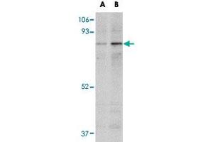 Western blot analysis of NAA35 in mouse heart tissue lysate with NAA35 polyclonal antibody  at (A) 1 and (B) 2 ug/mL .