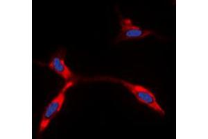 Immunofluorescent analysis of Kir6. (KCNJ11 抗体  (Center))