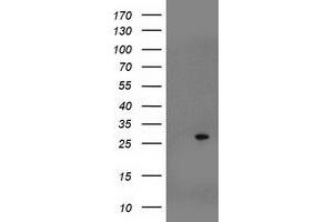 Western Blotting (WB) image for anti-Suppressor of Cytokine Signaling 3 (SOCS3) antibody (ABIN1501053) (SOCS3 抗体)
