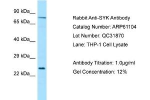 Western Blotting (WB) image for anti-Spleen tyrosine Kinase (SYK) (Middle Region) antibody (ABIN971831) (SYK 抗体  (Middle Region))