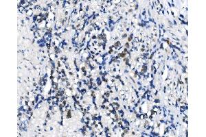 IHC analysis of METTL3 using anti-METTL3 antibody (ABIN7602808). (METTL3 抗体  (C-Term))