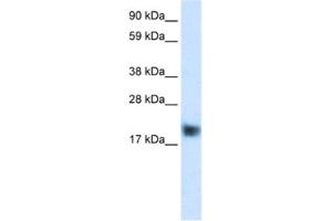 Western Blotting (WB) image for anti-Cysteine and Glycine-Rich Protein 3 (CSRP3) antibody (ABIN2460885) (CSRP3 抗体)
