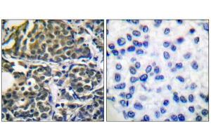 Immunohistochemistry (IHC) image for anti-Heat Shock Protein 90kDa alpha (Cytosolic), Class B Member 1 (HSP90AB1) (Ser254) antibody (ABIN1847890)