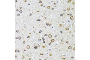Immunohistochemistry of paraffin-embedded mouse brain using  antibody (ABIN6129960, ABIN6136680, ABIN6136681 and ABIN6224707) at dilution of 1:100 (40x lens). (AIFM3 抗体  (AA 1-200))