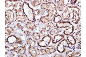 Paraformaldehyde-fixed, paraffin embedded human kidney tissue, Antigen retrieval by boiling in sodium citrate buffer(pH6) for 15min, Block endogenous peroxidase by 3% hydrogen peroxide for 30 minutes, Blocking buffer (normal goat serum) at 37°C for 20min, Antibody incubation with Rabbit Anti-Endomucin Polyclonal Antibody, Unconjugated  at 1:400 overnight at 4°C, followed by a conjugated secondary and DAB staining (Endomucin 抗体  (AA 181-261))
