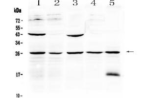 Western blot analysis of Noggin using anti-Noggin antibody . (NOG 抗体  (AA 43-153))