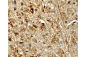 Immunohistochemical staining of mouse brain cells with ORMDL1 polyclonal antibody  at 5 ug/mL. (ORMDL1 抗体)