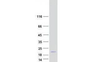Western Blotting (WB) image for Small Ubiquitin Related Modifier 2 (SUMO2) (Transcript Variant 1) protein (Myc-DYKDDDDK Tag) (ABIN2732981)