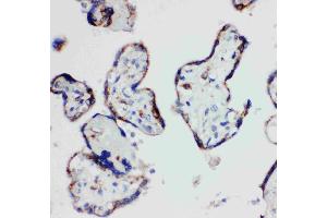 Anti-HSD17B1 antibody, IHC(P): Human Placenta Tissue (HSD17B1 抗体  (N-Term))