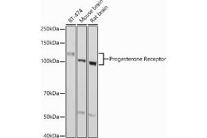 Western blot analysis of extracts of various cell lines, using Progesterone Receptor antibody (ABIN6128570, ABIN6145518, ABIN6145519 and ABIN6213802) at 1:1000 dilution. (Progesterone Receptor 抗体  (AA 1-250))