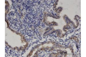 Immunoperoxidase of monoclonal antibody to PRODH on formalin-fixed paraffin-embedded human endometrium. (PRODH 抗体  (AA 441-540))