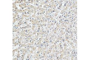 IHC analysis of STARD10 using anti-STARD10 antibody (ABIN7599199).