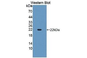Detection of Recombinant Slit3, Human using Polyclonal Antibody to Slit Homolog 3 (Slit3) (SLIT3 抗体  (AA 1405-1512))