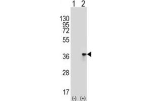 Western Blotting (WB) image for anti-Toll Interacting Protein (TOLLIP) antibody (ABIN3001486) (TOLLIP 抗体)