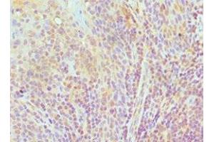 Immunohistochemistry of paraffin-embedded human tonsil tissue using ABIN7151592 at dilution of 1:100 (TCEB3 抗体  (AA 679-798))