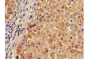 Immunohistochemistry of paraffin-embedded human liver tissue using ABIN7144595 at dilution of 1:100 (ASL 抗体  (AA 2-300))
