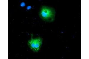 Anti-CALCOCO2 mouse monoclonal antibody (ABIN2454024) immunofluorescent staining of COS7 cells transiently transfected by pCMV6-ENTRY CALCOCO2 (RC203843). (CALCOCO2 抗体)