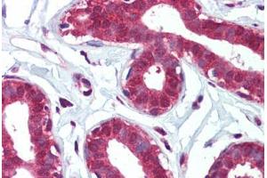 Human Breast (formalin-fixed, paraffin-embedded) stained with ITGA6 antibody ABIN462312 followed by biotinylated goat anti-rabbit IgG secondary antibody ABIN481713, alkaline phosphatase-streptavidin and chromogen. (ITGA6 抗体  (Ser1064))