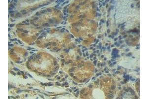 Detection of P-cadherin in Human Stomach Tissue using Polyclonal Antibody to Placental Cadherin (P-cadherin) (P-Cadherin 抗体  (AA 371-660))