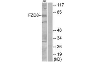 Western blot analysis of extracts from Jurkat cells, using FZD8 Antibody. (FZD8 抗体  (AA 31-80))