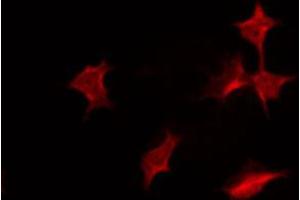 ABIN6267319 staining COS7 by IF/ICC. (Progesterone Receptor 抗体  (pSer400))