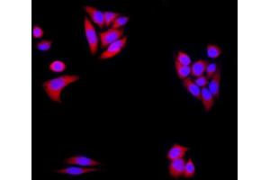 HeLa cells were stained with alpha-Synuclein Polyclonal Antibody, Unconjugated at 1:500 in PBS and incubated for two hours at 37°C followed by Goat Anti-Rabbit IgG (H+L) Cy3 conjugated secondary antibody.