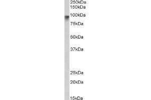 ABIN190848 (2µg/ml) staining of Human Pancrease lysate (35µg protein in RIPA buffer). (Neuroligin 2 抗体  (Internal Region))
