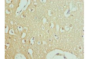 Immunohistochemistry of paraffin-embedded human brain tissue using ABIN7167017 at dilution of 1:100 (RPH3A 抗体  (AA 1-280))