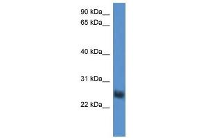 Western Blot showing SLA2 antibody used at a concentration of 1-2 ug/ml to detect its target protein. (SLAP2 抗体  (Middle Region))
