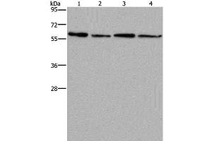 Western Blot analysis of Mouse kidney, liver, heart and brain tissue using CD297 Polyclonal Antibody at dilution of 1:667 (ART4 抗体)