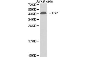 Western blot analysis of extracts of Jurkat cell lines, using TBP antibody. (TBP 抗体  (AA 1-100))