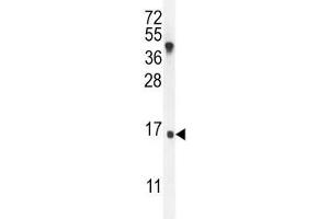 IGKV antibody western blot analysis in MDA-MB435 lysate. (IGKV A18 抗体  (AA 80-107))