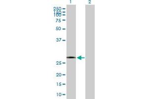 Western Blot analysis of KCTD15 expression in transfected 293T cell line by KCTD15 MaxPab polyclonal antibody. (KCTD15 抗体  (AA 1-234))