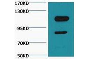 Western Blot (WB) analysis of Jurkat, diluted at 1:3000. (PARP1 抗体  (cleaved))