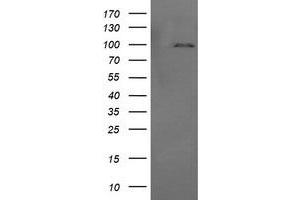 Image no. 2 for anti-Phosphoinositide-3-Kinase, Regulatory Subunit 5 (PIK3R5) antibody (ABIN1500212) (PIK3R5 抗体)