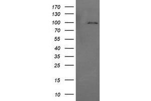 Image no. 2 for anti-Phosphoinositide-3-Kinase, Regulatory Subunit 5 (PIK3R5) antibody (ABIN1500212)