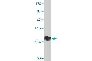 Western Blot detection against Immunogen (34. (Sphingomyelin Synthase 2 抗体  (AA 2-80))