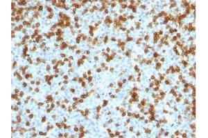 Formalin-fixed, paraffin-embedded human Tonsil stained with PD1 (CD279) Rabbit Recombinant Monoclonal Antibody (PDCD1/1410R). (Recombinant PD-1 抗体)