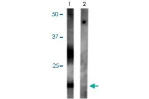 Western blot of rat kidney lysate showing specific immunolabeling of the ~ 29k and 37k glycosylated form of the Aqp2 protein phosphorylated at Ser261. (AQP2 抗体  (pSer2612))