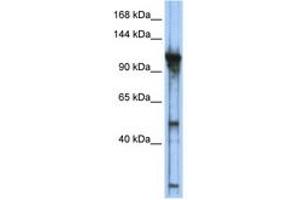 Image no. 1 for anti-General Transcription Factor IIIC, Polypeptide 2, beta 110kDa (GTF3C2) (AA 755-804) antibody (ABIN6742236) (GTF3C2 抗体  (AA 755-804))