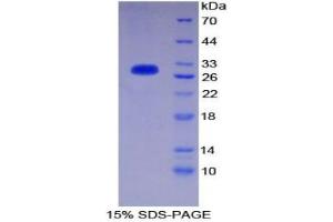 SDS-PAGE analysis of Mouse CD1d Protein. (CD1d 蛋白)