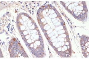 Immunohistochemistry of paraffin-embedded Human colon using HMGCR Polyclonal Antibody at dilution of 1:200 (40x lens). (HMGCR 抗体)