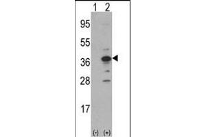 Western blot analysis of MCA1(arrow) using rabbit polyclonal MCA1 Antibody (N-term) (ABIN390679 and ABIN2840973). (MCA1 抗体  (C-Term))