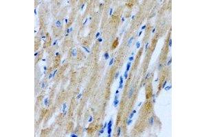Immunohistochemical analysis of Myomegalin staining in rat heart formalin fixed paraffin embedded tissue section. (PDE4DIP 抗体)