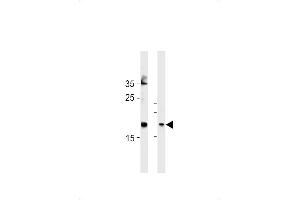 FA Antibody (Center) (ABIN1881332 and ABIN2843378) western blot analysis in Hela cell line and mouse bladder tissue lysates (35 μg/lane). (FAM159A 抗体  (AA 89-115))