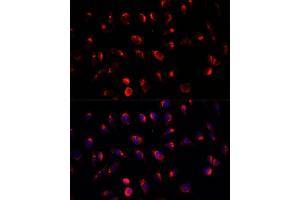 Immunofluorescence (IF) image for anti-UDP-N-Acetyl-alpha-D-Galactosamine:polypeptide N-Acetylgalactosaminyltransferase 2 (GalNAc-T2) (GALNT2) (AA 442-571) antibody (ABIN6140940)