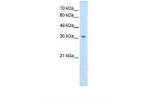 Image no. 1 for anti-Wingless-Type MMTV Integration Site Family, Member 16 (WNT16) (AA 270-319) antibody (ABIN320623) (WNT16 抗体  (AA 270-319))