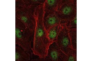 Immunofluorescence analysis of U251 cells using c-Rel mouse mAb (green). (c-Rel 抗体)